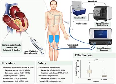 First-in-man application of Liwen RF™ ablation system in the treatment of drug-resistant hypertrophic obstructive cardiomyopathy